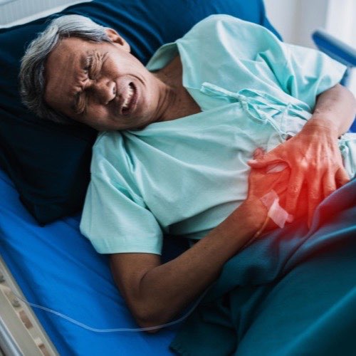 Kidney Transplant