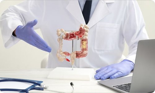 Hemorrhoidectomy